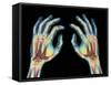 Coloured X-ray of Healthy Human Hands-Science Photo Library-Framed Stretched Canvas