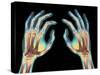 Coloured X-ray of Healthy Human Hands-Science Photo Library-Stretched Canvas