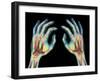 Coloured X-ray of Healthy Human Hands-Science Photo Library-Framed Photographic Print