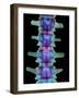 Coloured X-ray of Lumbar Vertebrae of the Spine-Science Photo Library-Framed Photographic Print