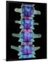 Coloured X-ray of Lumbar Vertebrae of the Spine-Science Photo Library-Framed Photographic Print