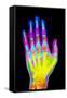 Coloured X-ray of the Healthy Hand of a Man-Mehau Kulyk-Framed Stretched Canvas