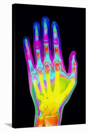 Coloured X-ray of the Healthy Hand of a Man-Mehau Kulyk-Stretched Canvas
