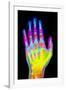 Coloured X-ray of the Healthy Hand of a Man-Mehau Kulyk-Framed Photographic Print