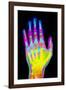 Coloured X-ray of the Healthy Hand of a Man-Mehau Kulyk-Framed Photographic Print