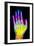 Coloured X-ray of the Healthy Hand of a Man-Mehau Kulyk-Framed Photographic Print