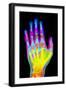 Coloured X-ray of the Healthy Hand of a Man-Mehau Kulyk-Framed Photographic Print