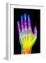 Coloured X-ray of the Healthy Hand of a Man-Mehau Kulyk-Framed Photographic Print