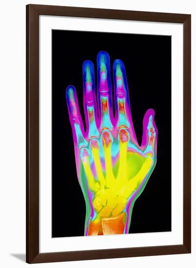 Coloured X-ray of the Healthy Hand of a Man-Mehau Kulyk-Framed Photographic Print