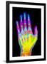 Coloured X-ray of the Healthy Hand of a Man-Mehau Kulyk-Framed Photographic Print