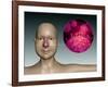 Common Cold Influenza Virus with Microscopic Close-Up-null-Framed Art Print