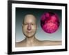 Common Cold Influenza Virus with Microscopic Close-Up-null-Framed Art Print