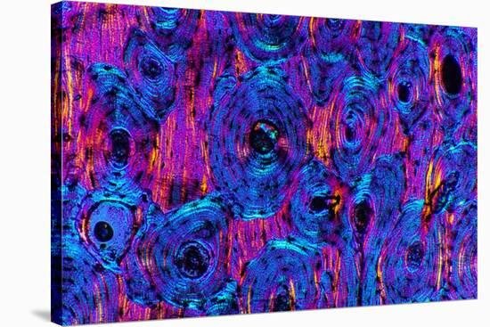 Compact Bone, Light Micrograph-Dr. Keith Wheeler-Stretched Canvas