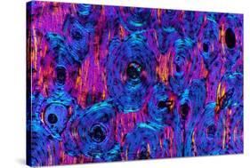 Compact Bone, Light Micrograph-Dr. Keith Wheeler-Stretched Canvas