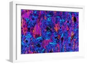 Compact Bone, Light Micrograph-Dr. Keith Wheeler-Framed Photographic Print