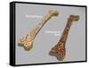 Comparison of a Healthy Bone and a Bone with Osteoporosis-null-Framed Stretched Canvas