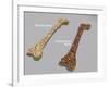 Comparison of a Healthy Bone and a Bone with Osteoporosis-null-Framed Art Print