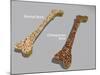 Comparison of a Healthy Bone and a Bone with Osteoporosis-null-Mounted Art Print