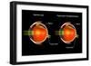 Comparison of a normal eye and an eye with hyperopia.-Stocktrek Images-Framed Art Print