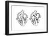 Comparison of Normal Heart Versus Heart with a Patent Foramen Ovale-null-Framed Art Print