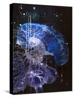 Conceptual Art of Brain & Nerve Cells In Dementia-Hans-ulrich Osterwalder-Stretched Canvas