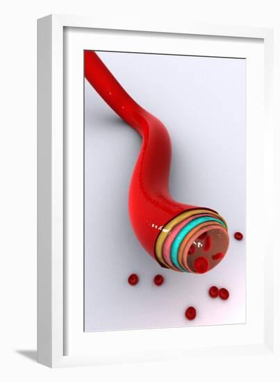 Conceptual Image of a Blood Vessel-null-Framed Art Print