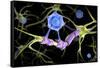 Conceptual image of a multiple sclerosis neuron healed by a T-cell.-Stocktrek Images-Framed Stretched Canvas