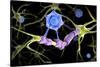 Conceptual image of a multiple sclerosis neuron healed by a T-cell.-Stocktrek Images-Stretched Canvas