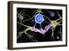 Conceptual image of a multiple sclerosis neuron healed by a T-cell.-Stocktrek Images-Framed Premium Giclee Print