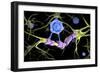 Conceptual image of a multiple sclerosis neuron healed by a T-cell.-Stocktrek Images-Framed Premium Giclee Print