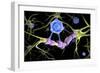 Conceptual image of a multiple sclerosis neuron healed by a T-cell.-Stocktrek Images-Framed Premium Giclee Print