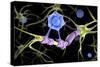 Conceptual image of a multiple sclerosis neuron healed by a T-cell.-Stocktrek Images-Stretched Canvas