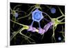 Conceptual image of a multiple sclerosis neuron healed by a T-cell.-Stocktrek Images-Framed Art Print