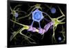 Conceptual image of a multiple sclerosis neuron healed by a T-cell.-Stocktrek Images-Framed Art Print