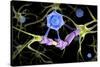 Conceptual image of a multiple sclerosis neuron healed by a T-cell.-Stocktrek Images-Stretched Canvas