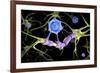 Conceptual image of a multiple sclerosis neuron healed by a T-cell.-Stocktrek Images-Framed Art Print