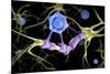 Conceptual image of a multiple sclerosis neuron healed by a T-cell.-Stocktrek Images-Mounted Art Print