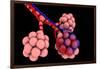 Conceptual Image of Alveoli-null-Framed Art Print