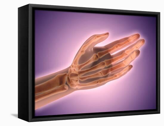 Conceptual Image of Bones in Human Hand-null-Framed Stretched Canvas