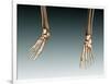Conceptual Image of Bones in Human Legs and Feet-null-Framed Art Print
