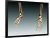 Conceptual Image of Bones in Human Legs and Feet-null-Framed Art Print