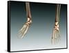 Conceptual Image of Bones in Human Legs and Feet-null-Framed Stretched Canvas