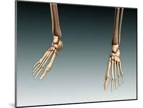 Conceptual Image of Bones in Human Legs and Feet-null-Mounted Art Print