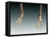 Conceptual Image of Bones in Human Legs and Feet-null-Framed Stretched Canvas