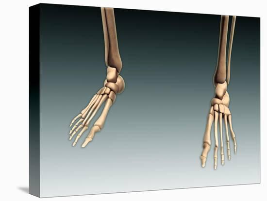 Conceptual Image of Bones in Human Legs and Feet-null-Stretched Canvas