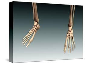 Conceptual Image of Bones in Human Legs and Feet-null-Stretched Canvas