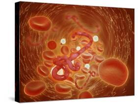 Conceptual Image of Ebola Virus in Artery-null-Stretched Canvas