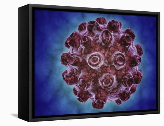 Conceptual Image of Encephalitis-null-Framed Stretched Canvas