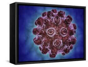 Conceptual Image of Encephalitis-null-Framed Stretched Canvas