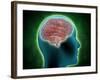 Conceptual Image of Female Body with Brain, Side View-null-Framed Art Print